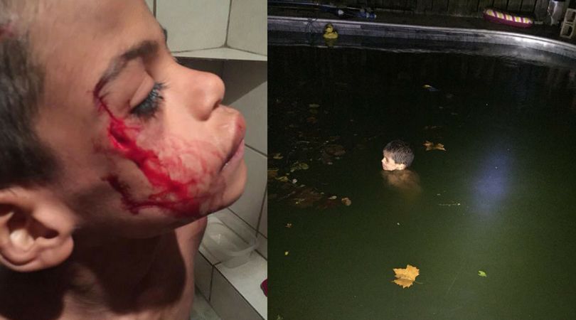 Fotografie wykonywane przez macochę ukazujące tortury nad Adrianem