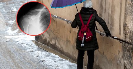 Przybywa pacjentów z urazami. "Sama zima nie jest niczemu winna"