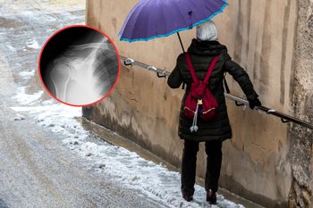 Przybywa pacjentów z urazami. "Sama zima nie jest niczemu winna"