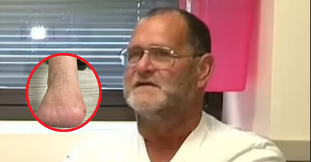 Wybrał się na ryby. Przez jedno ukąszenie amputowano mu palce