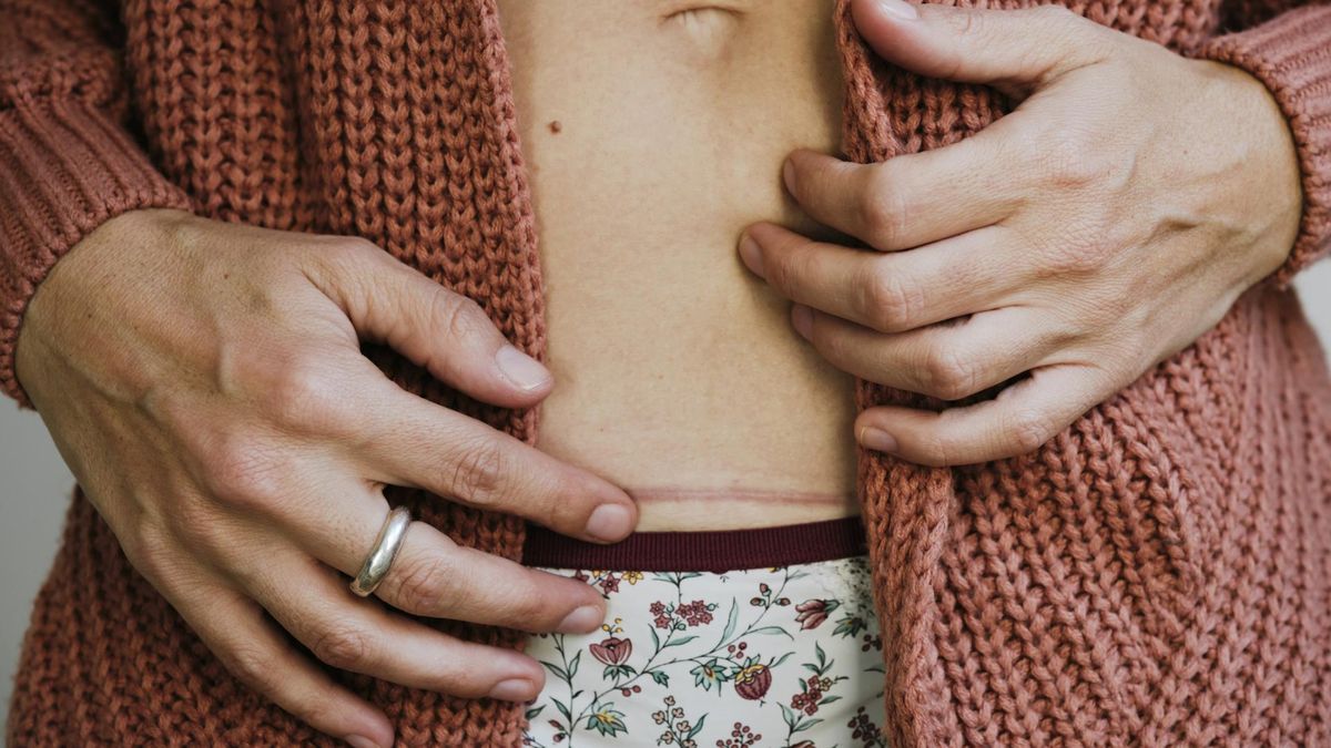 Cesarskie cięcie - ile trwa, przygotowania, wskazania, przebieg