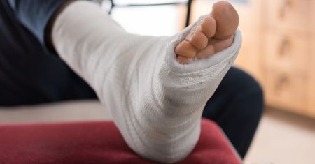 Złamanie trójkostkowe – przyczyny, leczenie i rehabilitacja