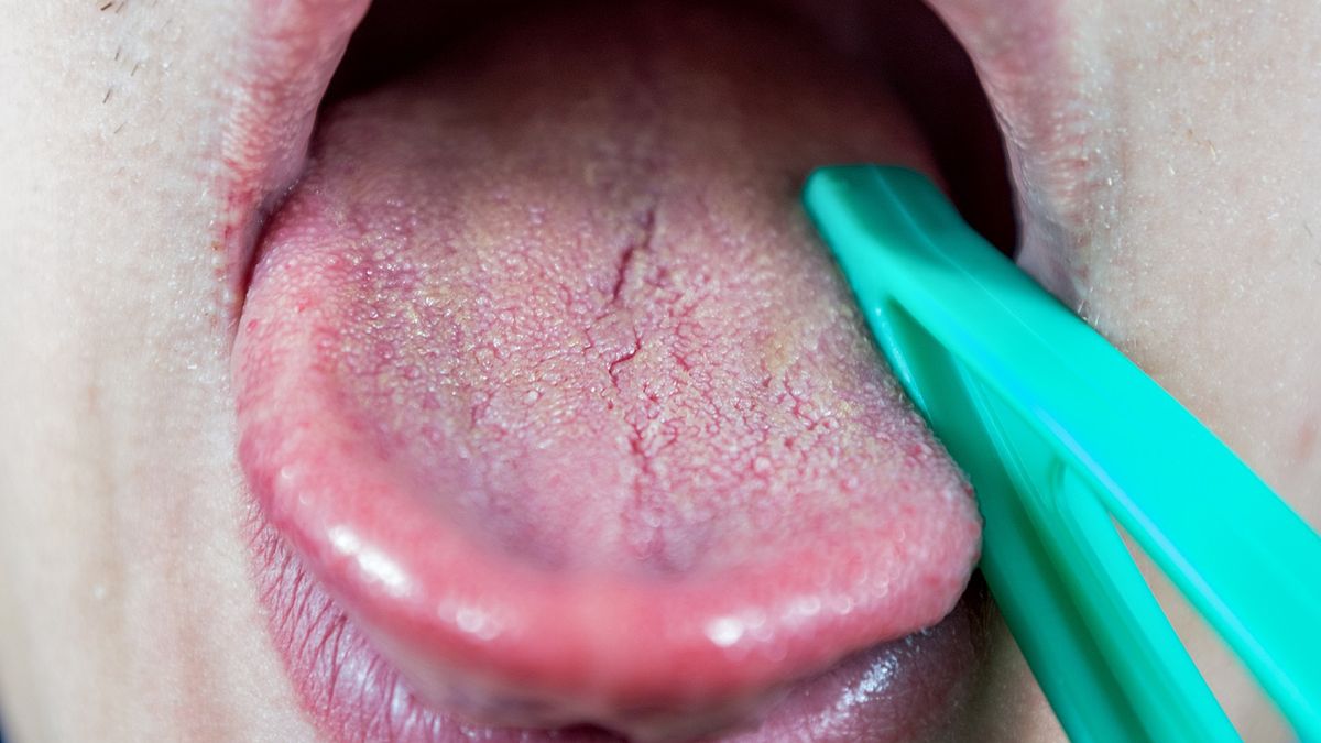 Ten objaw niedoboru zauważysz na języku. Może świadczyć nawet o anemii