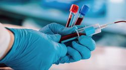 Antygen SCC w diagnostyce i monitorowaniu raka płaskonabłonkowego