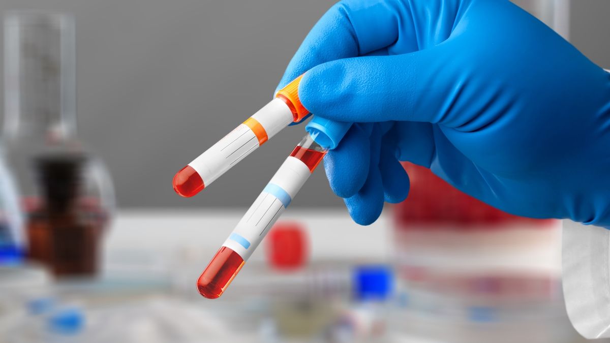 OB (odczyn Biernackiego) to marker stanu zapalnego w organizmie.