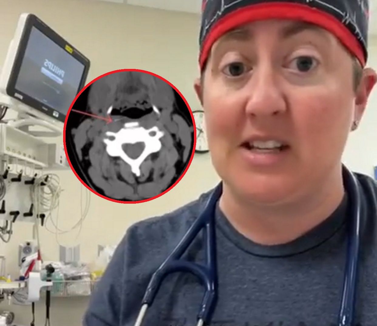 Lekarka ostrzega przed tym przedmiotem do czyszczenia 