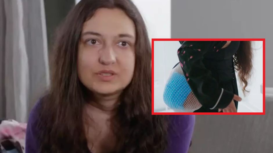 Guzek był wielkości orzecha laskowego. Dziś monstrualna zmiana waży 10 kg