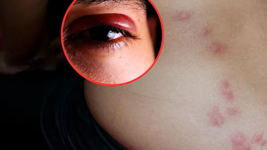 Atakują w nocy, rano pojawia się ślad. Nigdy go nie lekceważ