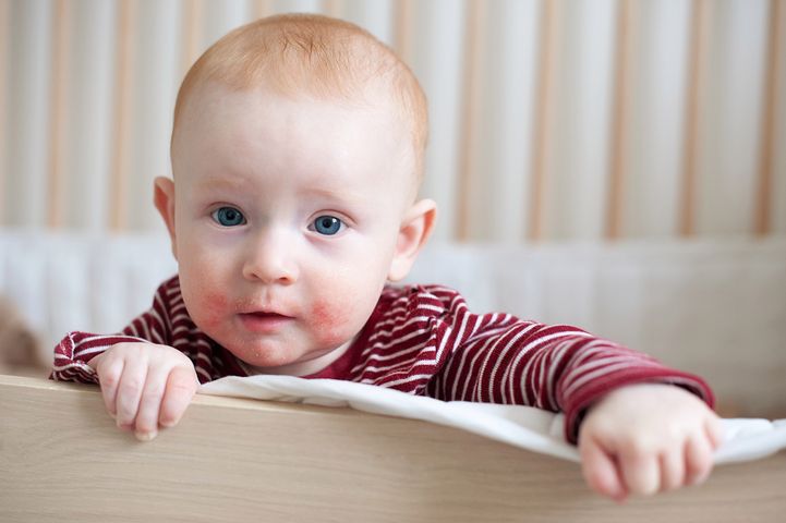 Alergia pokarmowa u niemowląt ma związek z niedojrzałością układu immunologicznego.