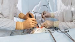 Przeszczep przeciwko gospodarzowi