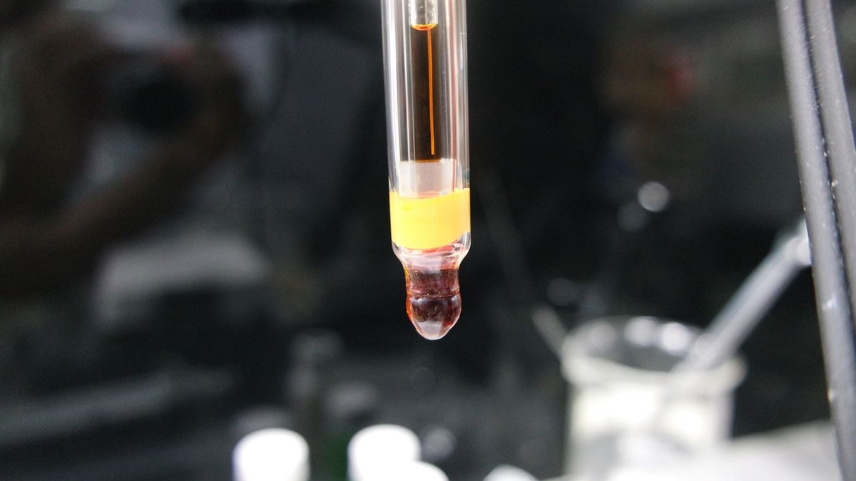 U ludzi kwas sialowy występuje głównie w postaci kwasu N-acetyloneuraminowego (Neu5Ac)