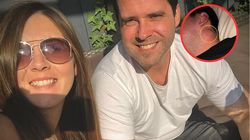 Pierwszy objaw pojawił się na szyi. Rak zajął płuca, wątrobę, mózg