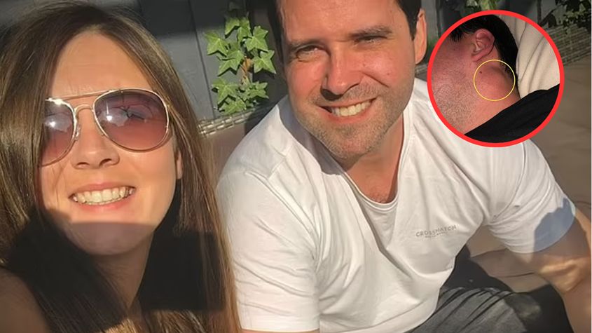 Myślał, że to torbiel, a dostał diagnozę czerniaka. "To był dla nas ogromny szok"