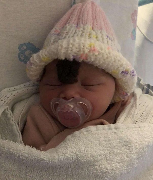 Vienna urodziła się ze znamieniem na środku czoła