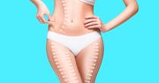 Lipoliza iniekcyjna – kiedy warto zdecydować się na zabieg?