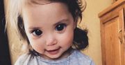 Dziewczynka z największymi oczami. Tak wygląda po latach