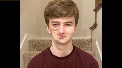 Jego twarz się zapadła. Lekarze wskazali przyczynę