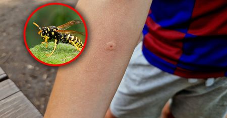 Niebezpieczne ukąszenie szerszenia, osy i pszczoły. Może wywołać wstrząs anafilaktyczny
