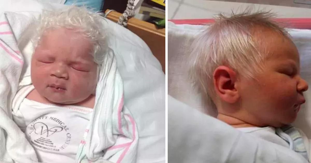 Niemowlę ze śnieżnobiałymi włosami