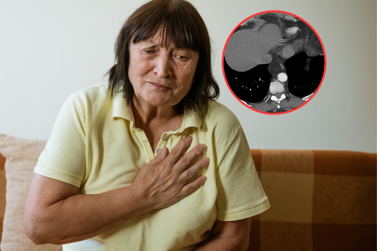 Bardzo rzadki, ale groźny nowotwór. Jakie objawy daje rak przełyku?