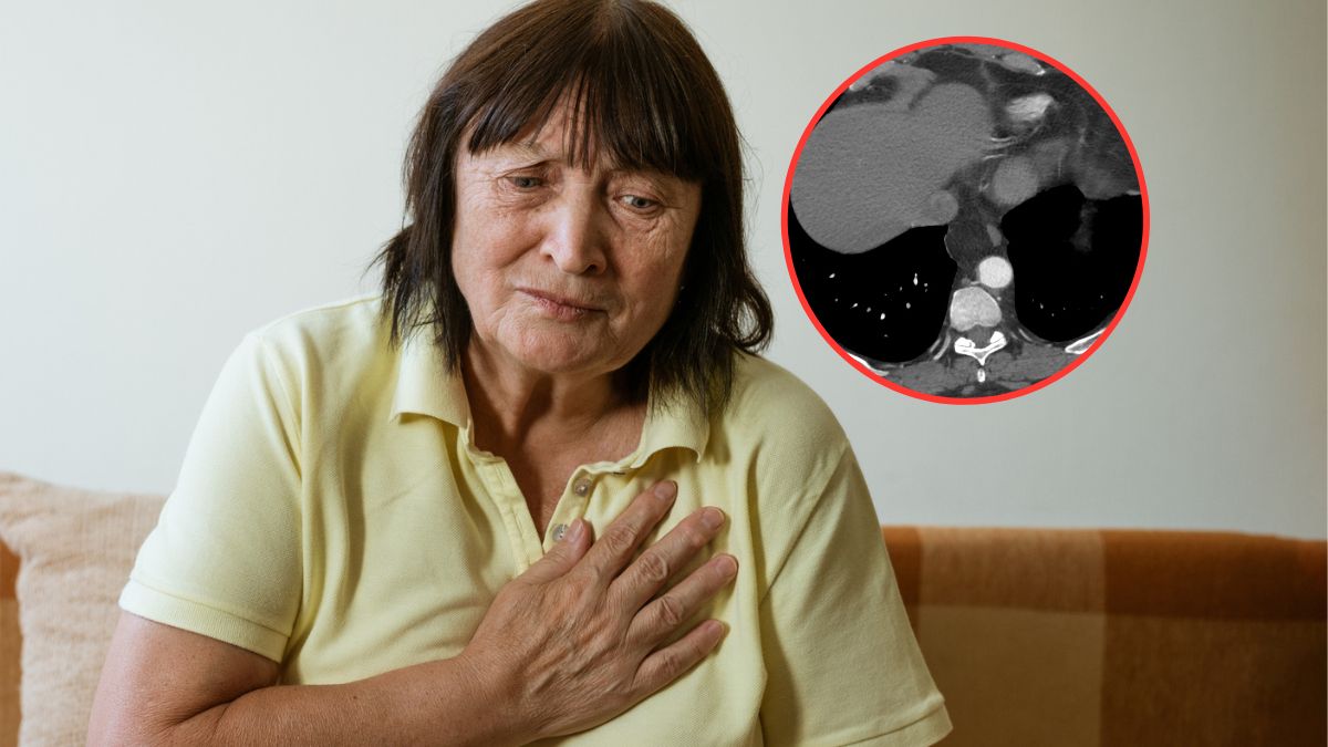 Rak przełyku diagnozowany jest u ponad tysiąca Polaków rocznie