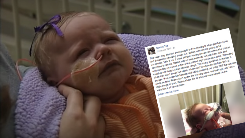 Noworodek chorujący na krztusiec