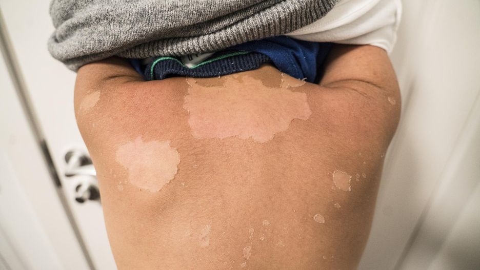 Wystawiają maluchy na „trochę słoneczka”. Eksperci ostrzegają rodziców