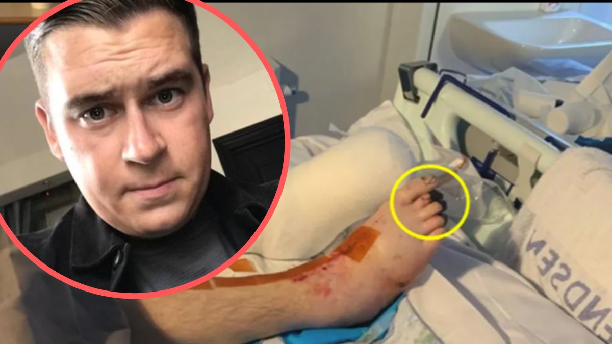 Myślał, że to przeziębienie - sepsa niemal go zabiła