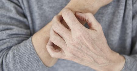 Autoimmunologiczne choroby skóry – przykłady i objawy