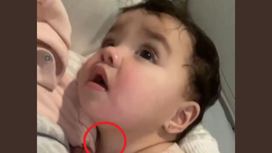 Zauważyłeś ten objaw u dziecka? Biegnij do lekarza