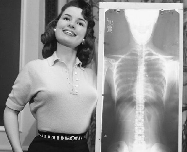 Miss Poprawnej Postawy