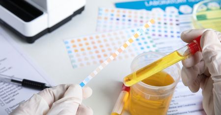 Glukozuria – przyczyny, objawy i leczenie
