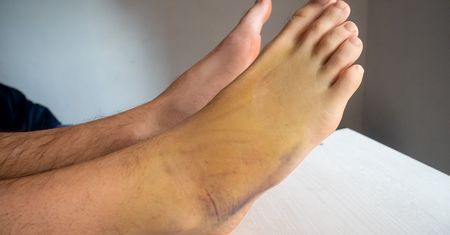 Dlaczego po szczepionce na COVID-19 dochodzi do zakrzepów? Ekspert wymienia dwie możliwości