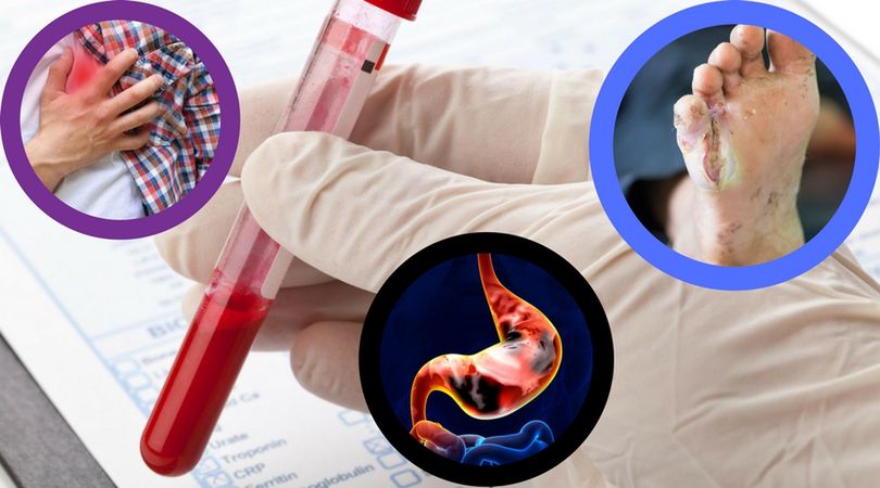 Grupa krwi ma wpływ na wystąpienie poważnych chorób! Sprawdź, na co możesz zachorować