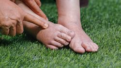 Ogranicz te produkty. To przez nie puchną nogi i twarz