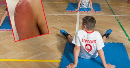 Lekarka apeluje do nauczycieli. Pokazała zdjęcie nastoletniego pacjenta