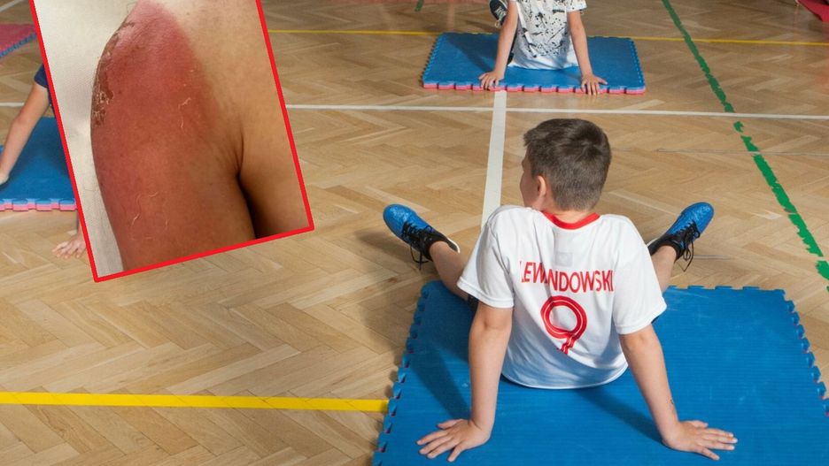 Kremy z filtrem są zalecane do zabaw na dworze