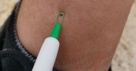 Kleszcze nie znoszą tej grupy krwi. Od tych osób trzymają się z daleka