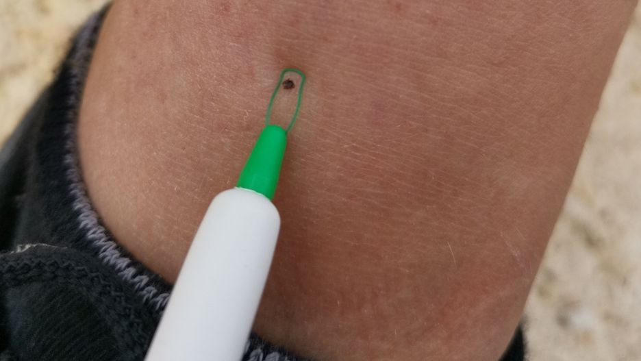 Grupa krwi, której nie lubią kleszcze