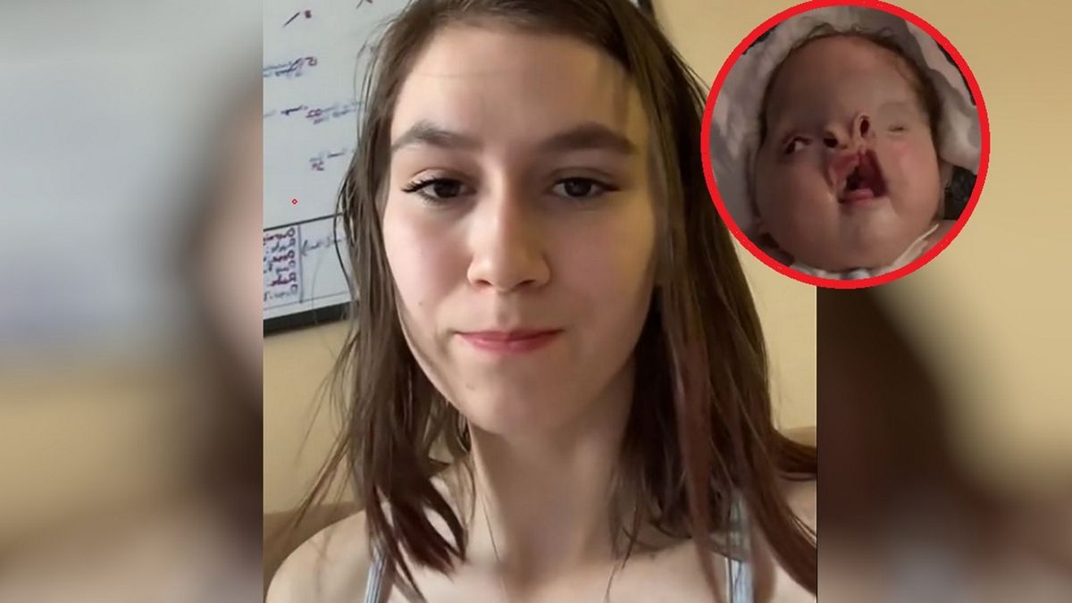 Ciężka wada wrodzona chłopca wywołała lawinę okropnych komentarzy