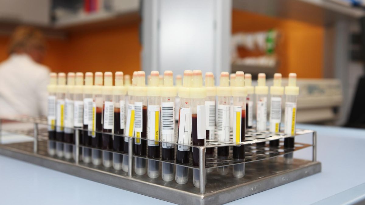 Grupy krwi - charakterystyka, grupa krwi 0, grupa krwi A, grupa krwi B, grupa krwi AB