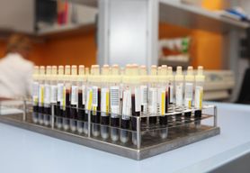 Czy grupa krwi może zwiększać ryzyko rozwoju niektórych chorób?