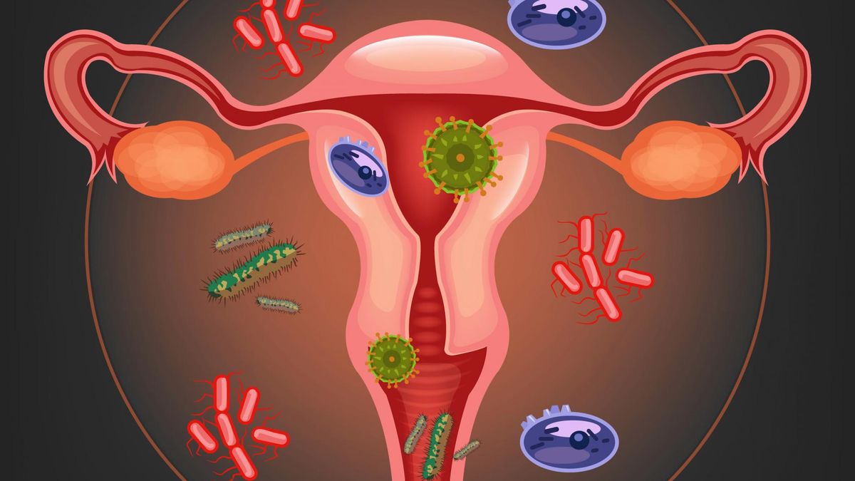 Czym charakteryzują się bakteryjne infekcje pochwy?