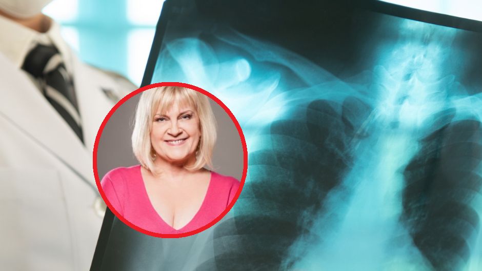Nie żyje Marzena Kipiel-Sztuka. Aktorka zmagała się m.in. z przewlekłą obturacyjną chorobą płuc