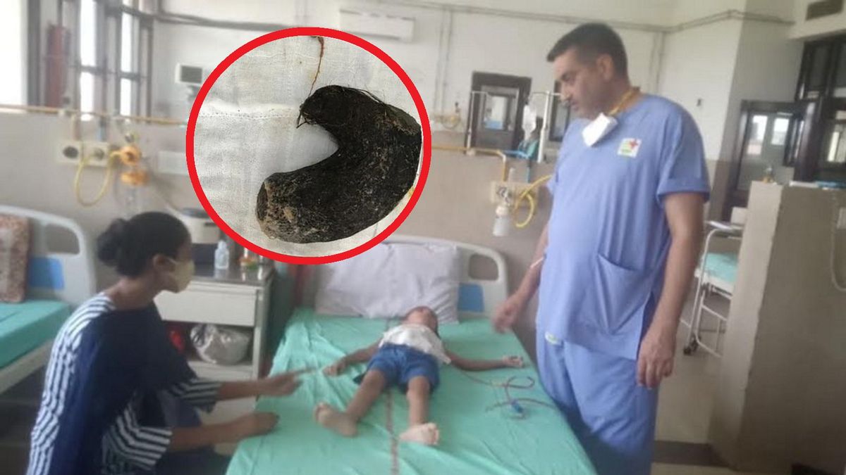 5-latka skarżyła się na ból brzucha. Szokujące znalezisko w brzuchu dziecka