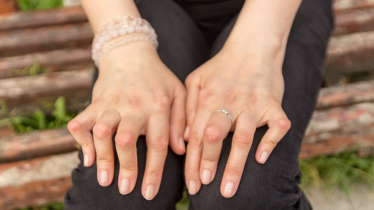 Choroba boleśnie uszkadza stawy