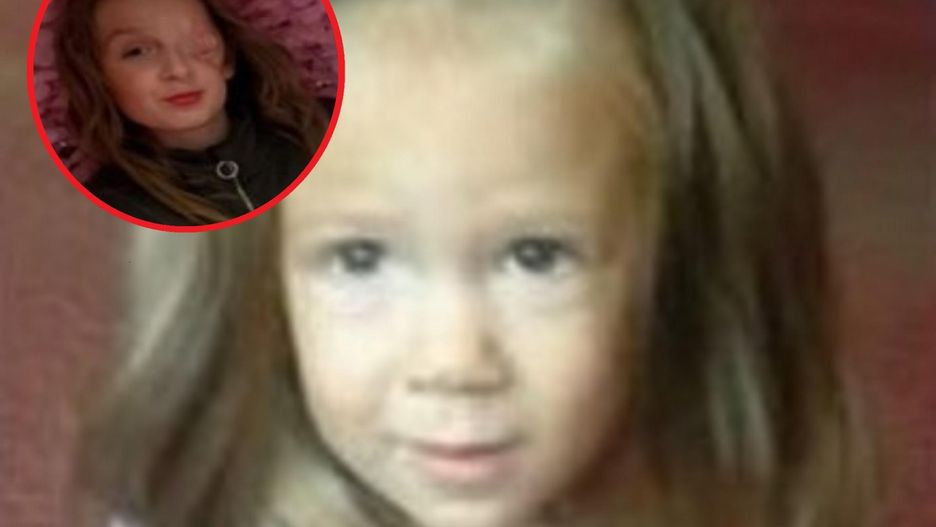 Lekarze wierzyli, że przebyta enukleacja pomoże jej pokonać chorobę