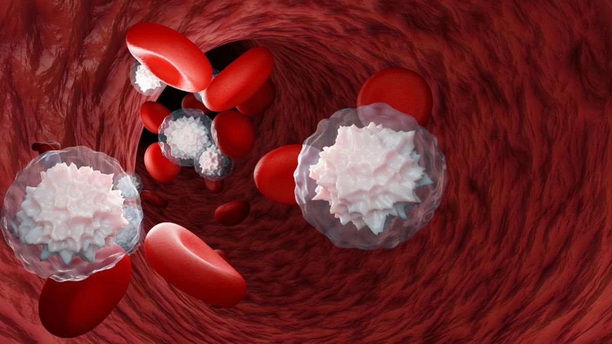 Choć chłoniaki i białaczki często nie wywołują żadnych objawów, są niebezpieczne.