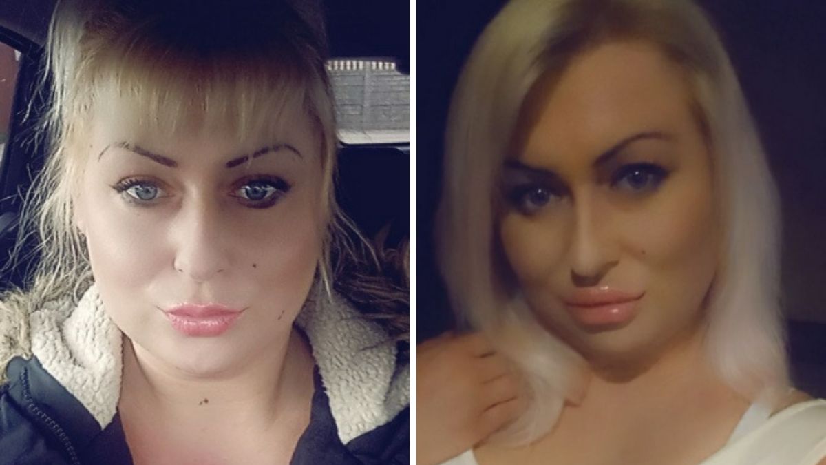 Ewelina uważa, że zabieg jest dla niej formą terapii