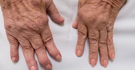 Choroby przewlekłe - charakterystyka, przykłady, wpływ na psychikę, diagnostyka